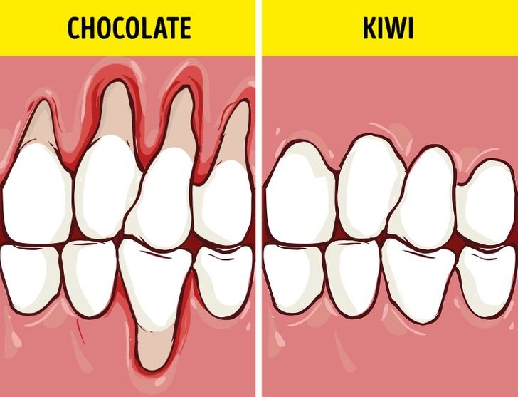 What Foods We Need To Eat To Keep Our Teeth Healthy And White Wikidame